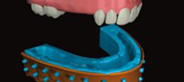 http://dr-diss-antoine.chirurgiens-dentistes.fr/dentiste/cms/upload/2_source/fiche/empreinte-3.jpg