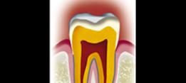 http://dr-diss-antoine.chirurgiens-dentistes.fr/dentiste/cms/upload/2_source/fiche/dent32.jpg