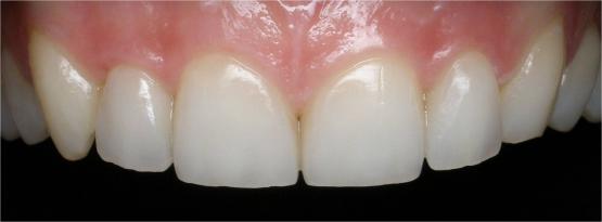 http://dr-diss-antoine.chirurgiens-dentistes.fr/dentiste/cms/upload/59_docteur-diss/fiche/exemple03_03.jpg