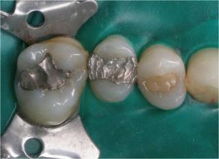 http://dr-diss-antoine.chirurgiens-dentistes.fr/dentiste/cms/upload/59_docteur-diss/fiche/posterrieur_01.jpg