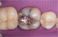 http://dr-diss-antoine.chirurgiens-dentistes.fr/dentiste/cms/upload/59_docteur-diss/fiche/posterieur_03.jpg