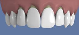 http://dr-diss-antoine.chirurgiens-dentistes.fr/dentiste/cms/upload/2_source/fiche/vignette2.jpg