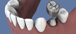 http://dr-diss-antoine.chirurgiens-dentistes.fr/dentiste/cms/upload/2_source/fiche/vign-coiffe.jpg