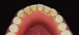 http://dr-diss-antoine.chirurgiens-dentistes.fr/dentiste/cms/upload/2_source/fiche/tarte.jpg