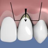 http://dr-diss-antoine.chirurgiens-dentistes.fr/dentiste/cms/upload/59_docteur-diss/fiche/epithelio-1B.jpg