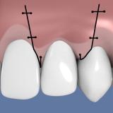 http://dr-diss-antoine.chirurgiens-dentistes.fr/dentiste/cms/upload/59_docteur-diss/fiche/epithelio-1C.jpg