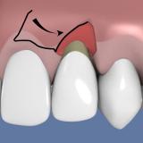http://dr-diss-antoine.chirurgiens-dentistes.fr/dentiste/cms/upload/59_docteur-diss/fiche/epithelio-2A.jpg
