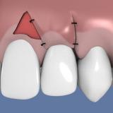 http://dr-diss-antoine.chirurgiens-dentistes.fr/dentiste/cms/upload/59_docteur-diss/fiche/epithelio-2D.jpg