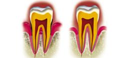 http://dr-diss-antoine.chirurgiens-dentistes.fr/dentiste/cms/upload/59_docteur-diss/fiche/parodontire.jpg