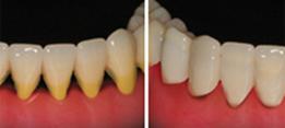 http://dr-diss-antoine.chirurgiens-dentistes.fr/dentiste/cms/upload/59_docteur-diss/fiche/dent-bougent.jpg