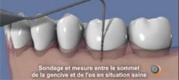 http://dr-diss-antoine.chirurgiens-dentistes.fr/dentiste/cms/upload/2_source/fiche/vign-paro.jpg