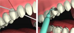 http://dr-diss-antoine.chirurgiens-dentistes.fr/dentiste/cms/upload/59_docteur-diss/fiche/vignetteparo22.gif