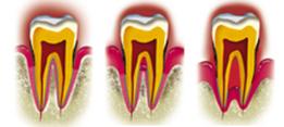 http://dr-diss-antoine.chirurgiens-dentistes.fr/dentiste/cms/upload/59_docteur-diss/fiche/maladie-parodontale.jpg