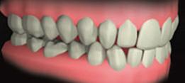 http://dr-diss-antoine.chirurgiens-dentistes.fr/dentiste/cms/upload/2_source/fiche/occlusion.jpg