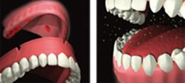 http://dr-diss-antoine.chirurgiens-dentistes.fr/dentiste/cms/upload/2_source/fiche/manque-salive.jpg