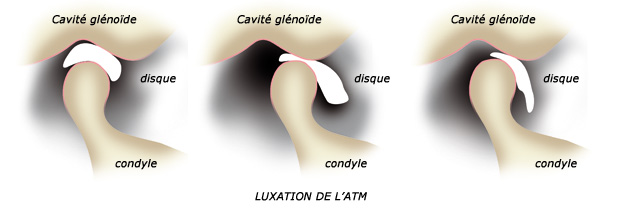 La mâchoire - Clinique chiropratique de l'ATM